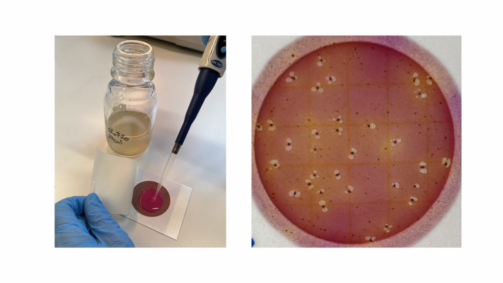 Petrifilm with ciprofloxacin-resistant gut-bacteria from stormwater containing sewer overflow. 